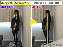 幸せのもり整体院/30代女性/会社員/Eさん