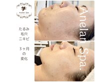 アネランスパ(Anelan Spa.)