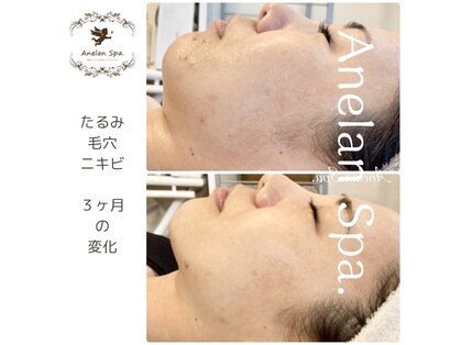アネランスパ(Anelan Spa.)の写真