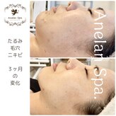 アネランスパ(Anelan Spa.)