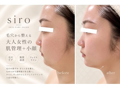 シロ(siro)の写真