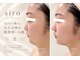 シロ(siro)の写真