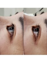 アイラッシュサロン モッペル(Eyelash Salon Moppel)/下がりまつげもくるん♪と改善