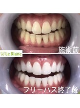 ルブラン 奈良店(Le Blanc)/３週間で驚きの変化！
