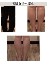 パワーパステル/美脚女子へ・下肢Ｏ脚悩み