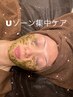 【ニキビケアに特化！】Uゾーン（頬・顎周り）◎ハーブピーリング　¥5,000-