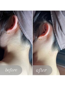 エピナス 町田店(epinus)/理想のうなじになれる!