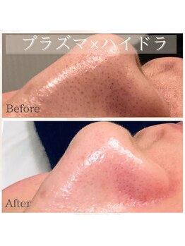 チェリーブロッサム 恵比寿店(CHERRY BLOSSOM)/ハイドラ×プラズマ