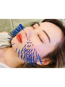 ホウレイ線・たるみ改善！予防ケア