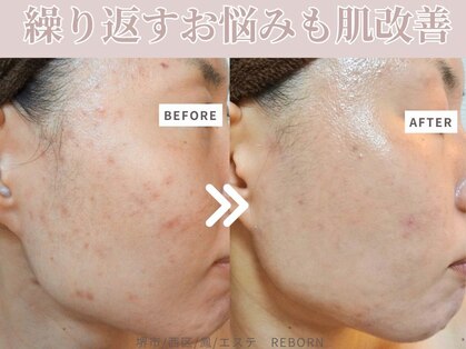 リボーン(Reborn)の写真