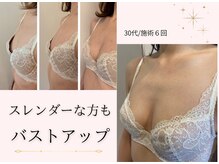 エイミー(Aimee)/スレンダーな方でもバストアップ