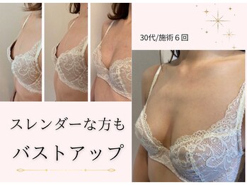 エイミー(Aimee)/スレンダーな方でもバストアップ