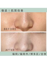 ソワ 吉塚店(soi)/驚異のトーンアップ！！