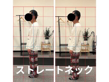 カワル整体 長嶺院/ストレートネック