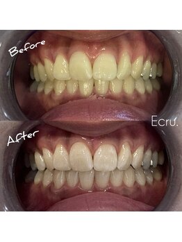 エクリュ(Ecru)/1回でここまで！？