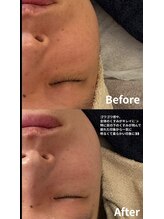 ニコ(nico)/目の下のくすみにも♪