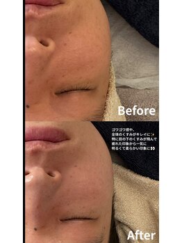 ニコ(nico)/目の下のくすみにも♪