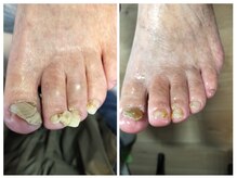 フレッシュフット(FreshFoot)/足のトラブルお任せください