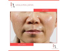 ナル ゆあん鍼灸接骨院(nalu)の雰囲気（ツヤ・ハリUPララピール【美容鍼/肩こり/小顔/整体/毛穴洗浄】）