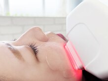 ディオネの雰囲気（内側からふんわり持ち上がる、新感覚リフトケア◎）