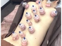 誠心経絡整体院の雰囲気(カッピング、気、血液、水分の流れ良くして軽い体へ!)