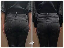 ブラックスワン(Black Swan)/