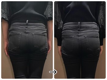 ブラックスワン(Black Swan)/