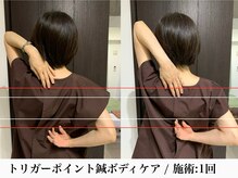 フラット(flat)/慢性的な肩こり・頭痛にオススメ