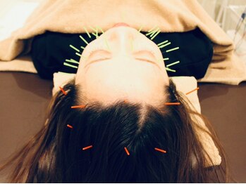 クマノミ美容鍼灸 川越院(KUMANOMI美容鍼灸)/頭皮からもしっかりリフトUP