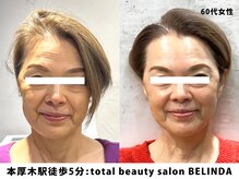 ベリンダ(BELINDA)/【本厚木★初導入】セルマン