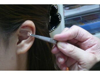 ひろスポーツ整体院/耳つぼシール貼付