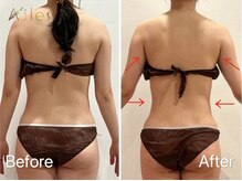 エール 恵比寿店(AILES)/20代全身リンパマッサージ