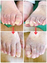 一宮巻き爪センター/巻き爪