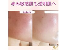 プライベートサロン 美月の雰囲気（【結果重視】様々からアプローチで立体的小顔&肌質改善へ！）