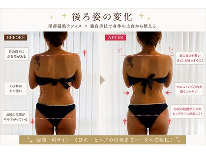 ルーチェスト(Lucest)の写真