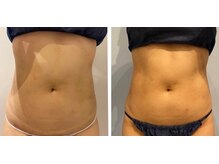 ルナグランデ(Luna grande.)/驚きの変化！