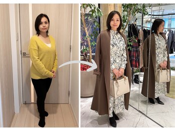 エピファニー 東京 銀座/ビフォーアフター(K.K様 40代)