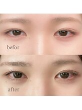 フォーヴリュンヌ(FOVLUNE)/ラッシュリフト