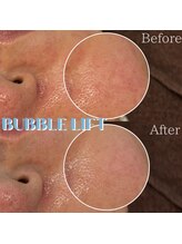 ポムハヌル 大阪梅田中崎町(pom.haneul)/韓国肌管理室