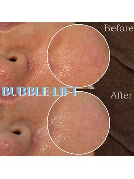 ポムハヌル 大阪梅田中崎町(pom.haneul)/韓国肌管理室