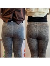 ドゥードル(doodle)/