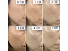 ノート(NOTE)の雰囲気（《しみケア20分＋美容液導入》）