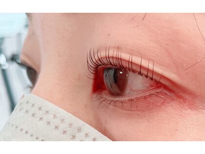 ベルアス(BELas)の写真