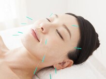 骨盤スタイル鍼灸院 接骨院 相模大野院の雰囲気(美容施術から小顔矯正まで根本改善に導きます!)