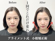 アライメントトウキョウ 麻布十番(Alignment TOKYO)/１回でもこれだけ変わる☆