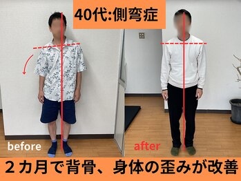 アオ整体院/40代男性ビフォーアフター☆