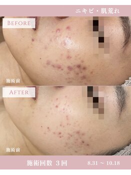 リリードボーテ 高槻店(LILY DE BEAUTE)/