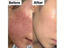 ミレ(mirae)の雰囲気（業界最多のテラスピキュールでお悩みを改善していきます◎）