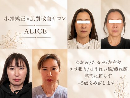 アリス(ALICE)の写真