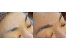 シュシュ(chouchou)/ハリウッドブロウリフト